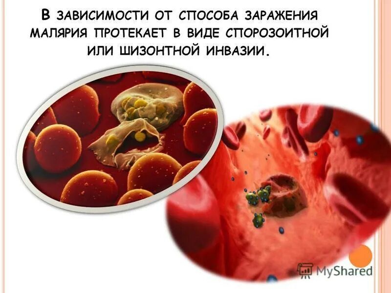 пути заражения человека малярией. малярийный комар способ заражения. малярийный плазмодий профилактика заболевания. путь заражения малярией. малярия способы передачи.