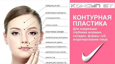 Точки мезотерапии
