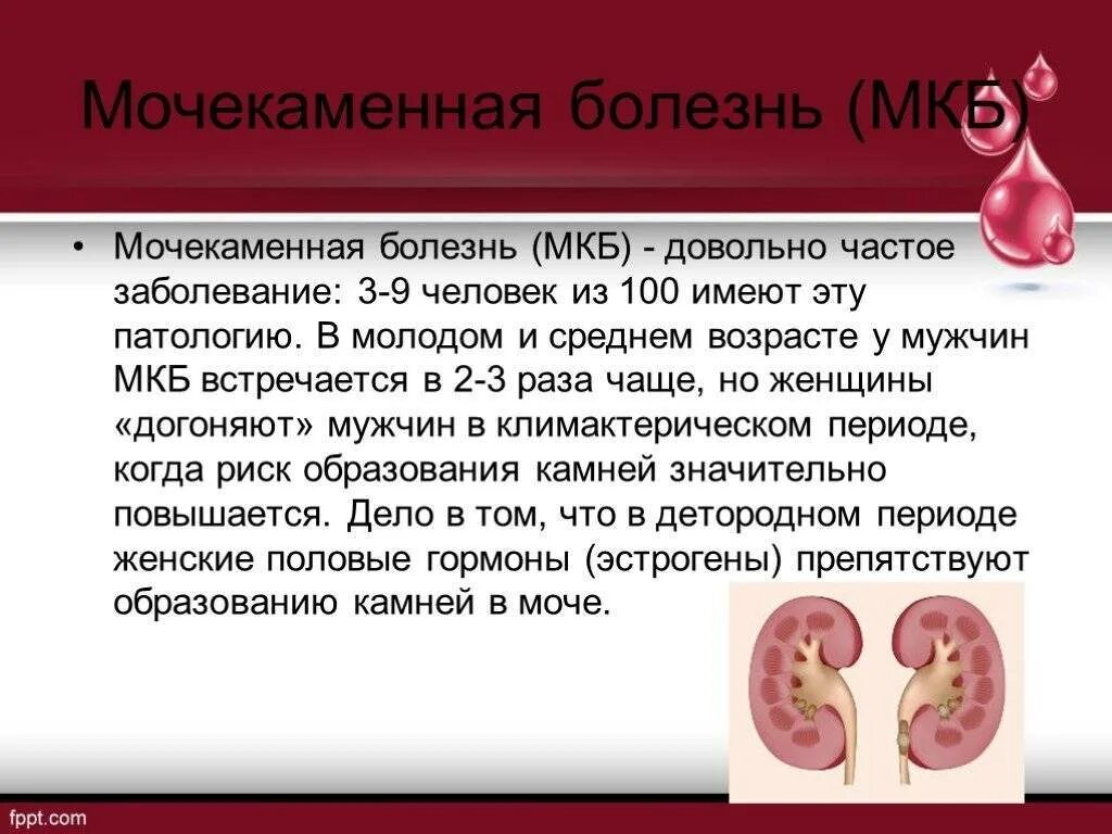 Моче-КАМНЕННАЯ болезнь. Мочекаменная болезнь презентация. Мочекаменная болезнь клинические проявления.