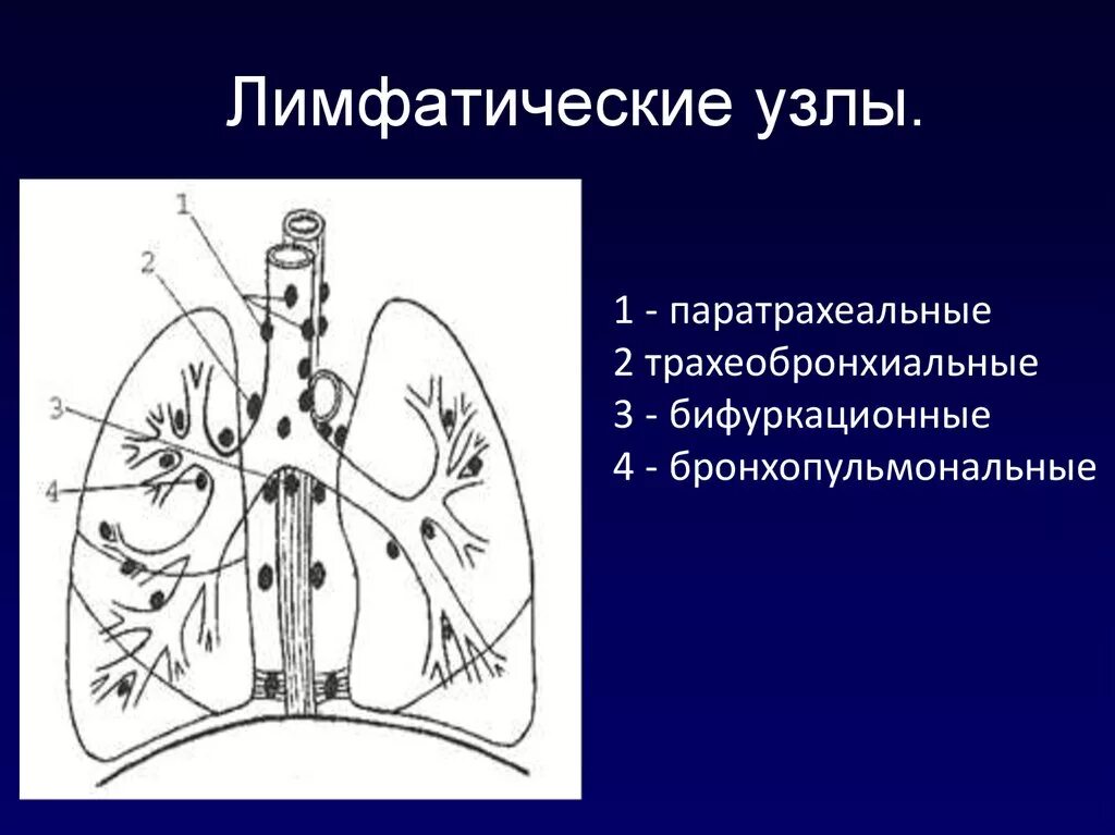 Легкие увеличен узел. Схема внутригрудных лимфоузлов. Лимфоузлы средостения кт анатомия. Бронхопульмональные лимфоузлы анатомия.