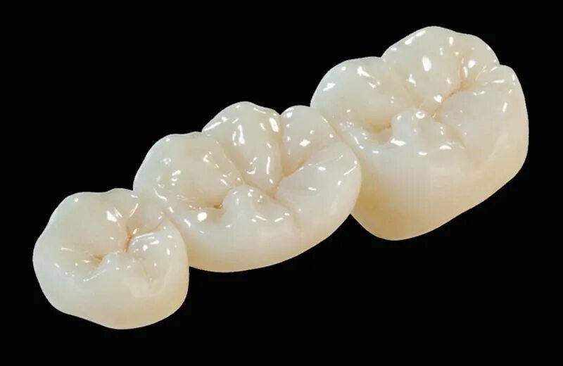 имплант винт абатмент коронка. коронка диоксид циркония и металлокерамика. абатмент zirconia nobel. безметалловая керамика а2 с а1. циркониевый имплант винтовой фиксации.