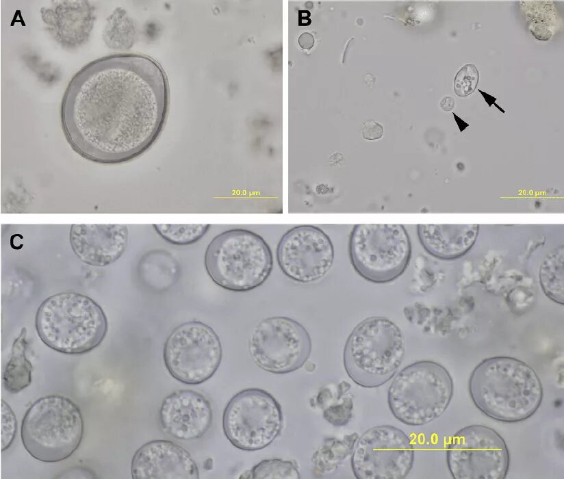 Простейшие в кале лечение. Токсоплазма ооцисты. Цисты лямблии микроскопия. Цисты лямблий микроскопия. Лямблии микроскопия кала.