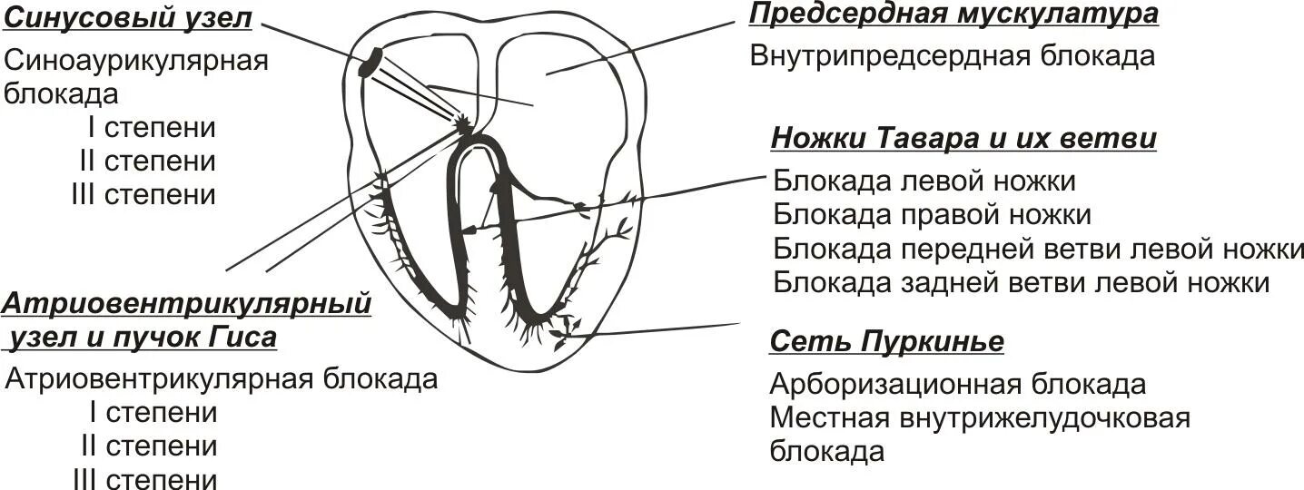 Блокада узла. ЭКГ при нарушении функции проводимости сердца. Блокада синусового узла 2 степени. Нарушение проводимости блокады сердца. Синусовый узел сердца.