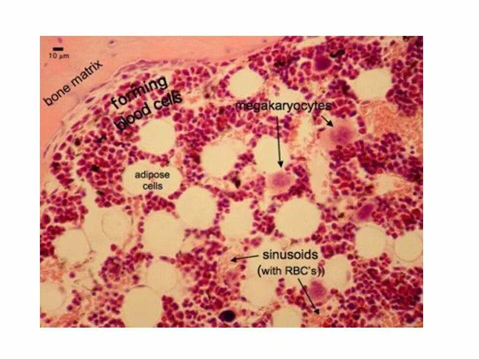 Красный костный мозг гистология. Bone marrow гистология. Клетки красного костного мозга гистология. Лучевая болезнь костный мозг гистология.