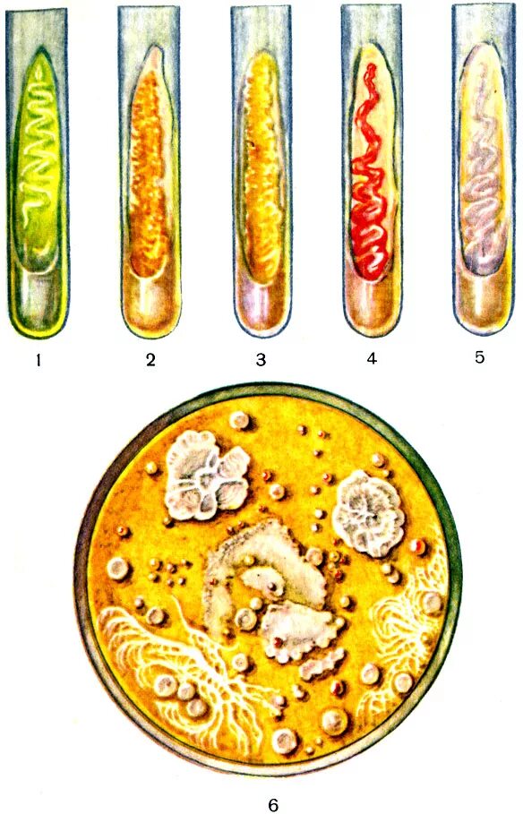 Колонии микроорганизмов пигментированные. Плотные питательные среды микробиология. Культуральные свойства бактерий пигменты бактерий. Формы колоний микроорганизмов на плотных питательных средах.