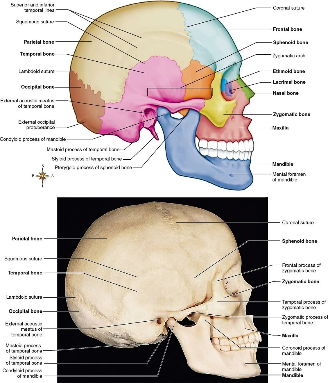Строение черепа над ухом. Височные кости черепа. Височная кость выпирает.