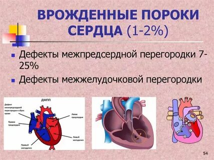 Порок 3 степени