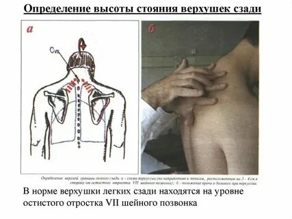 Верхняя граница грудной клетки