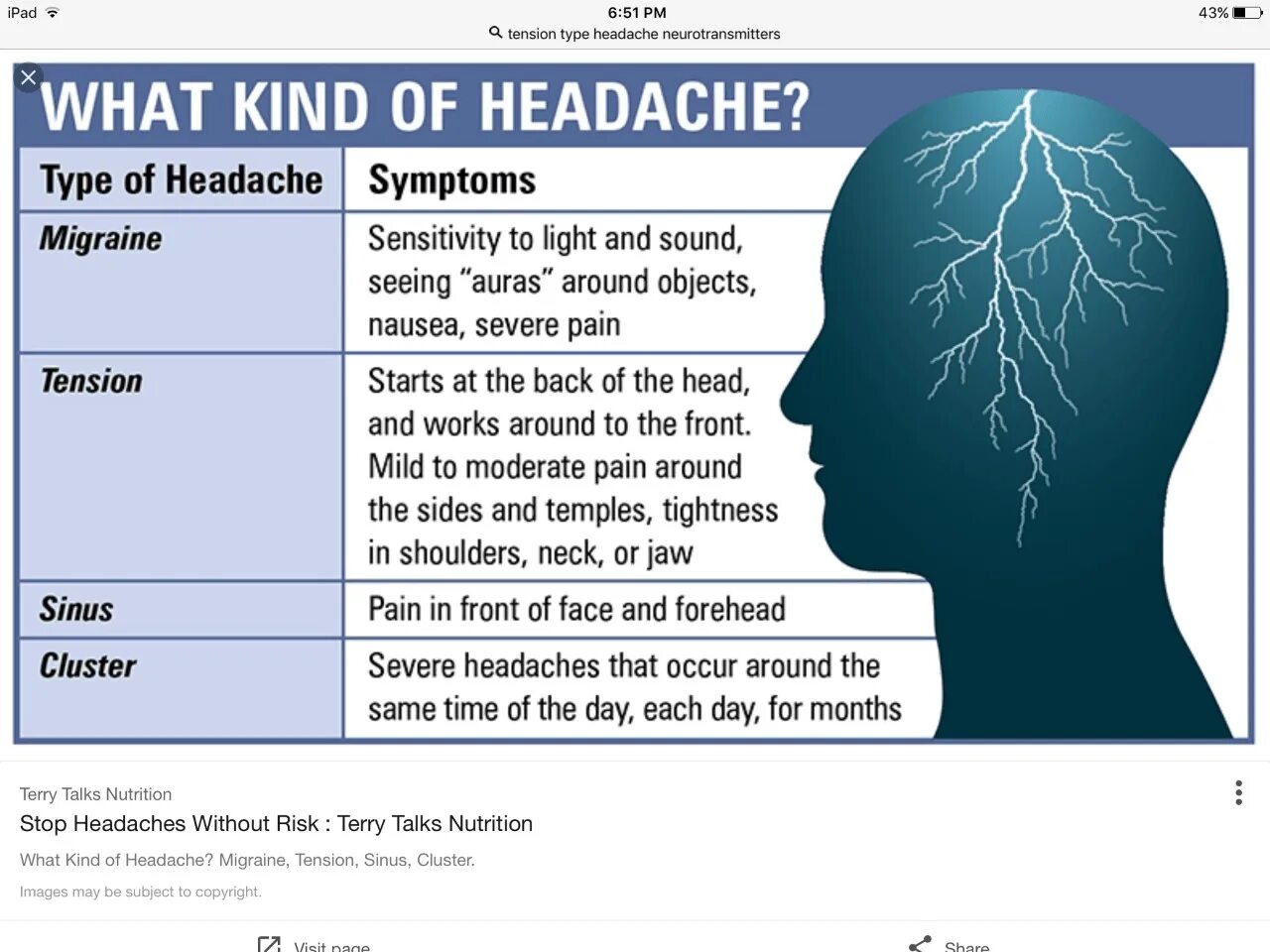 What kind of life is. Tension headache. Мигрень. Мигрень и головная боль напряжения. Мигрень картинки.