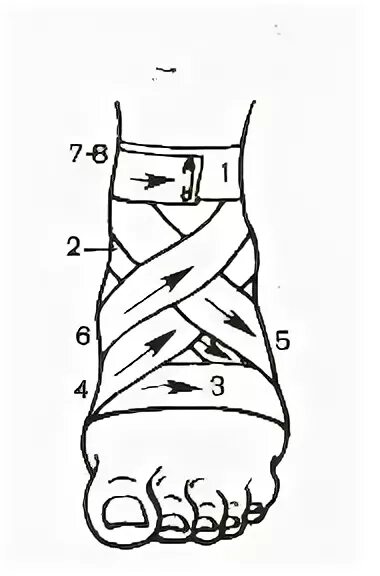 Восьмиобразная повязка на голеностопный сустав техника. Восьмиобразная повязка техника наложения. Восьмиобразная повязка на голеностоп алгоритм. Наложение восьмиобразной повязки на голеностопный сустав.