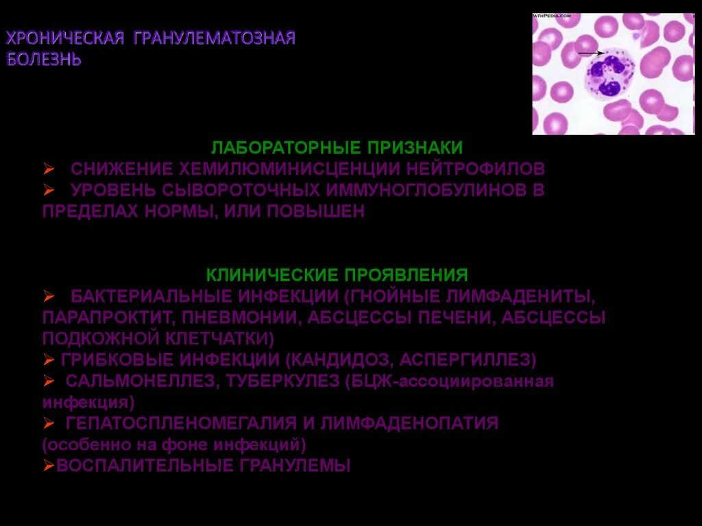 Может ли хроническое заболевание. Хроническая гранулематозная патогенез. Патогенез хронической гранулематозной болезни. Иммунология хронической гранулематозной болезни. Хронический гранулематоз патогенез.