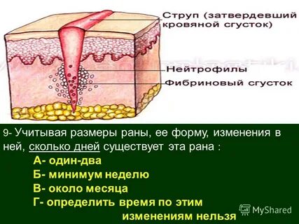 Размеры ран