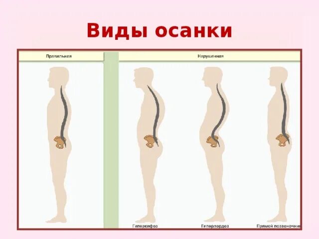 Осанка проект 9 класс Правильная осанка залог здоровья презентация онлайн