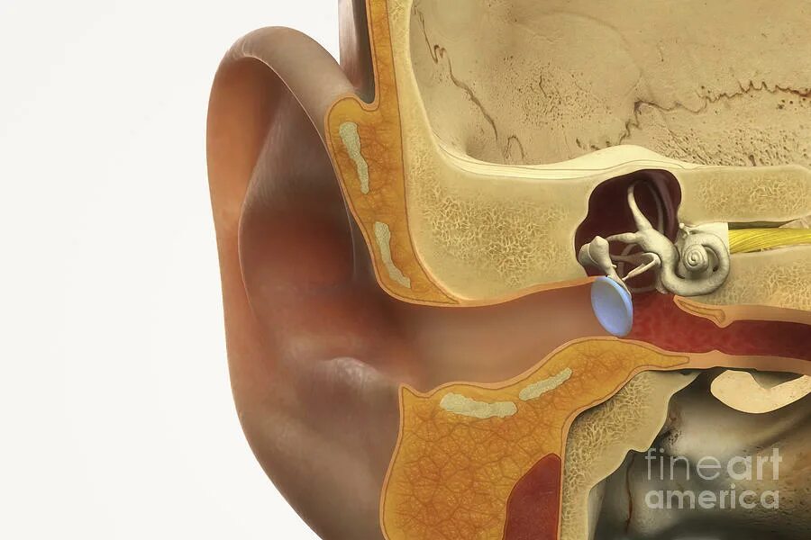 тимпанопластика, мирингопластика. уши 3 типа. тимпанопластика этапы операции. уши 3 типа. муляж уха.