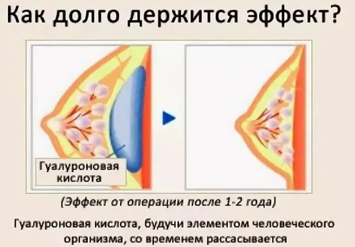 ПЫШНАЯ ГРУДЬ - это гордость женщины! И объект поклонения мужчин))) Сaмое главное
