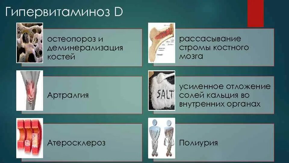 Остеопороз 4 степени. Деминерализация костной ткани. Кость текстура. Деминерализация костной ткани. Кость под микроскопом.