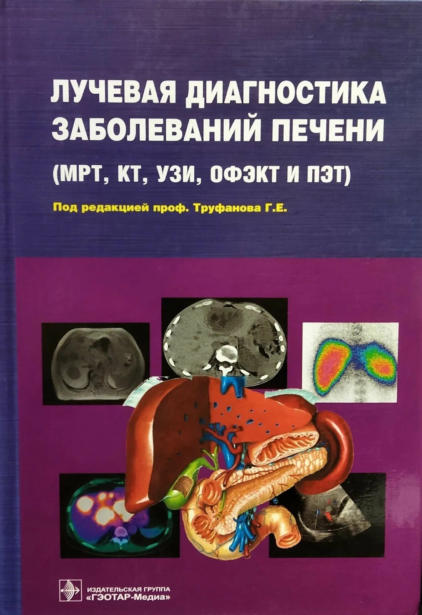 книги по лучевая диагностика головного мозга. лучевая диагностика травм. лучевая диагностика учебник труфанов. мрт руководство для врачей. учебник по рентгенологии.