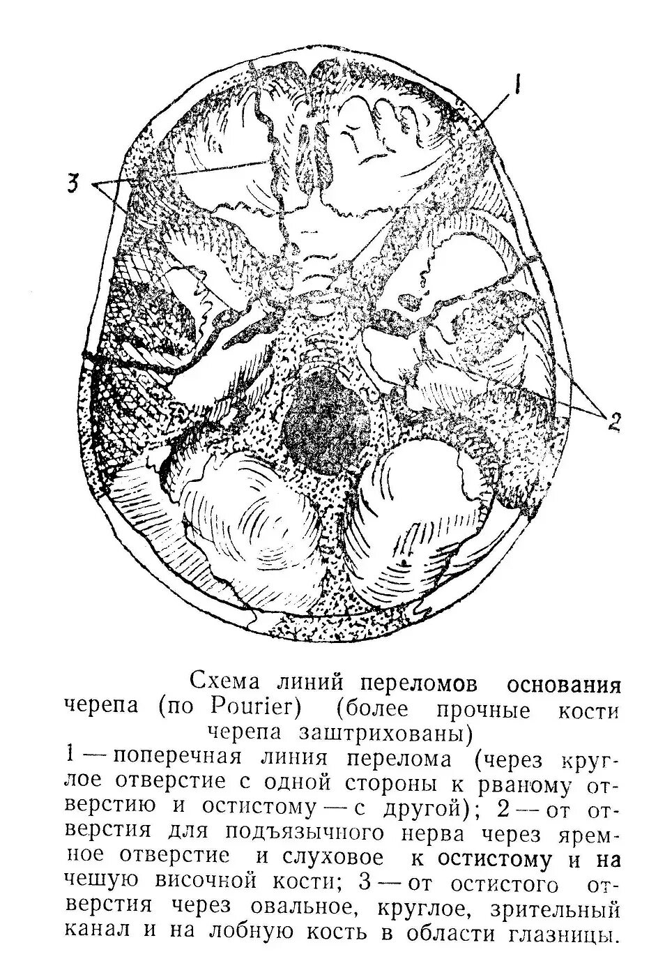 Области основания черепа. Линия основания черепа. Основание черепа. Внутренняя поверхность основания черепа. Внутренне основание черепа анатомия.