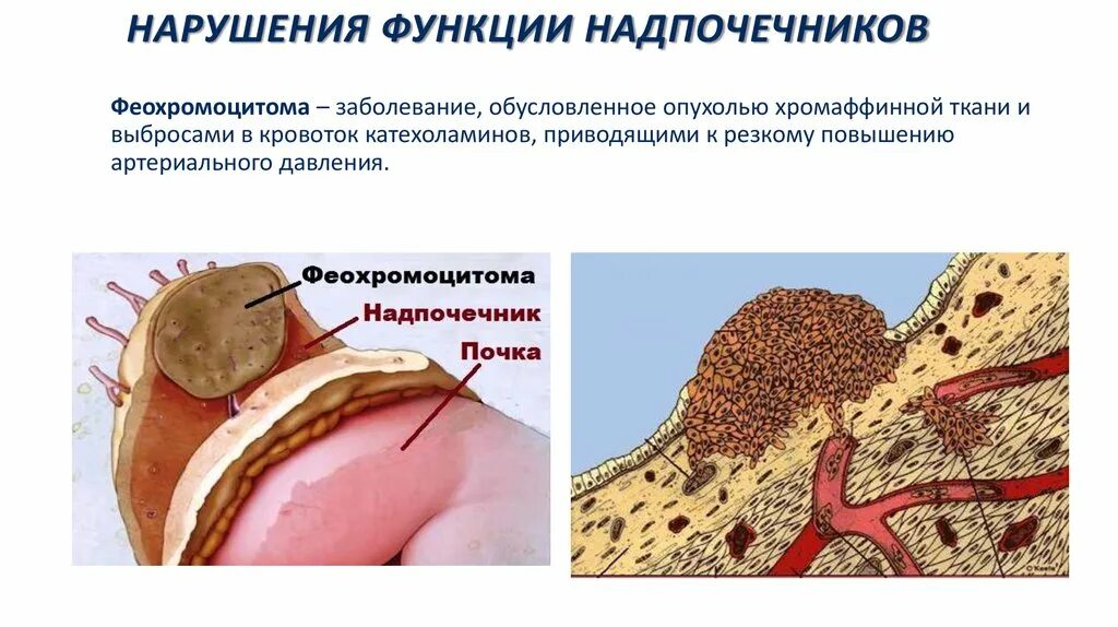 Гиперфункция коркового вещества надпочечников. Нарушение функции надпочечников. Поражение коры надпочечников. Нарушение функции коры надпочечников. Гиперфункция мозгового вещества надпочечников