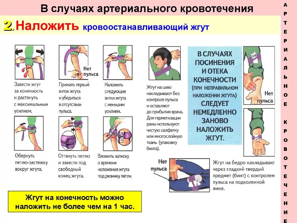 Жгут можно накладывать при кровотечении. В каких случаях накладывается кровоостанавливающий жгут. Жгут кровоостанавливающий для артериального кровотечения. Наложение кровоостанавливающего жгута при кровотечении. Правила наложения жгута при артериальном кровотечении.