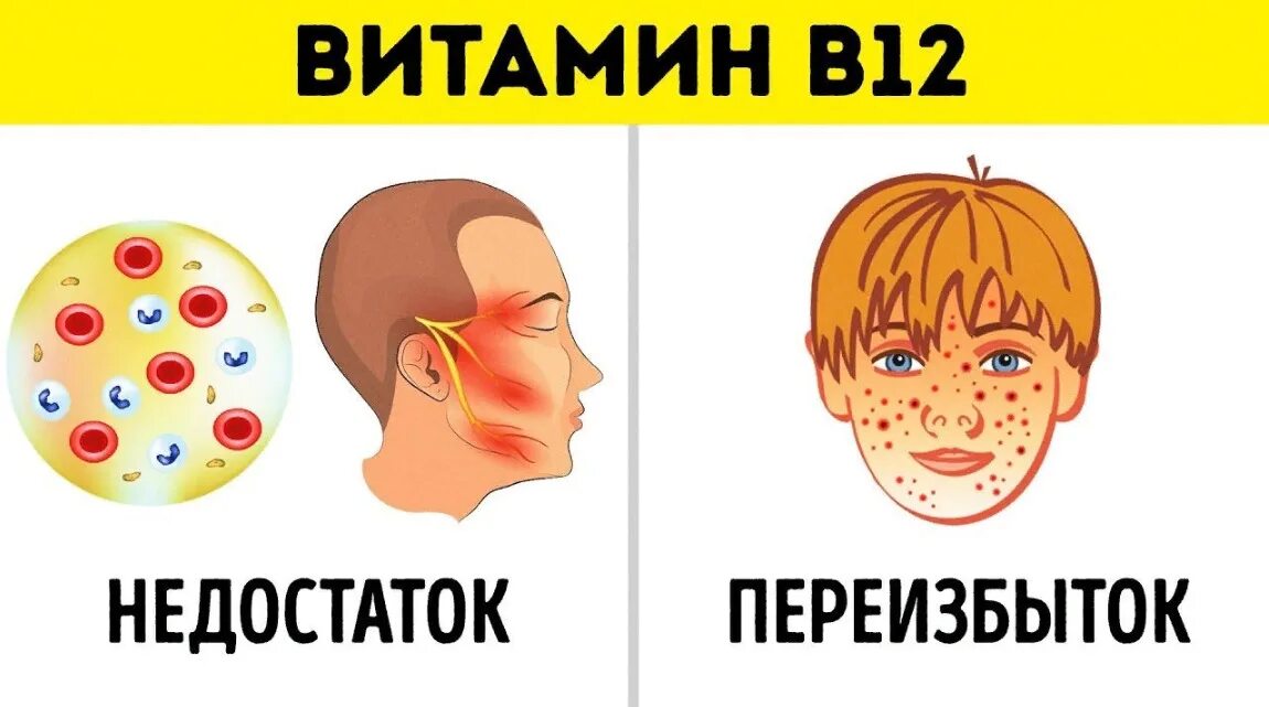 Нехватка б 12. Избыток витамина в12. Витамин в12 переизбыток в организме. Избыток витамина в12 последствия. Избыток витамина в12 симптомы.