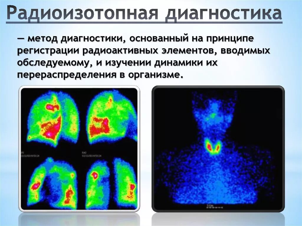 Исследование изотопами. Радиоизотопные методы исследования в онкологии. Исследование методом радиоизотопной диагностики. Радиоизотопное исследование (сцинтиграфия почек. Радиоизотопное исследование при заболеваниях пищевода.