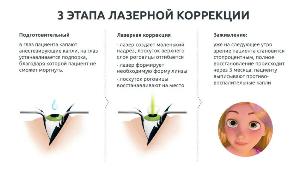 Коррекция года. Лазерная коррекция зрения. Операция на глаза для улучшения зрения. Минусы лазерной коррекции зрения. Лазерная коррекция зрения при миопии.