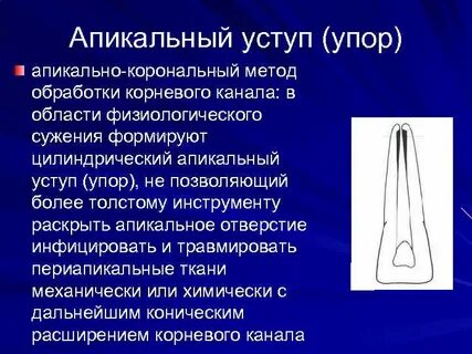 Апикальный упор