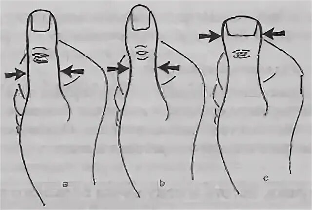 Правильная форма члена. Форма ногтевой фаланги хиромантия. Форма большого пальца на руке. Правильная форма пальцев. Разные формы пальцев.