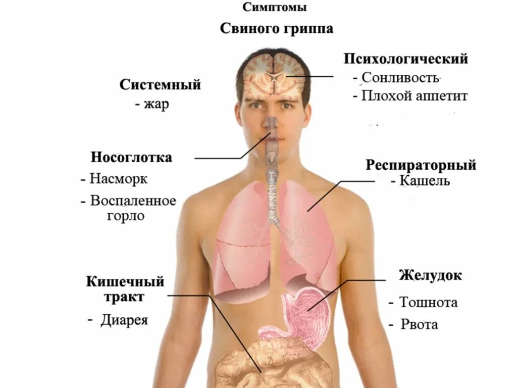Может ли быть тошнота при гриппе