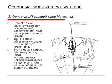 Сколько типов швов присутствует у человека