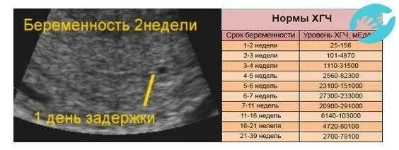 Может ли узи показать неправильно. Беременность на ранних сроках. беременность 2 недели 1 день задержки узи. маточная беременность на узи на раннем сроке беременности. беременность на 4 неделе до задержки.