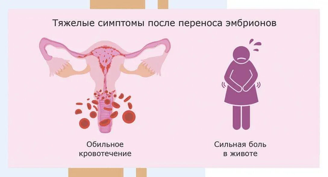 Перенос эмбриона какие ощущения. Эмбрион в матке после переноса. перенос эмбриона в матку эко. после переноса эмбрионов. симптомы после переноса эмбрионов.