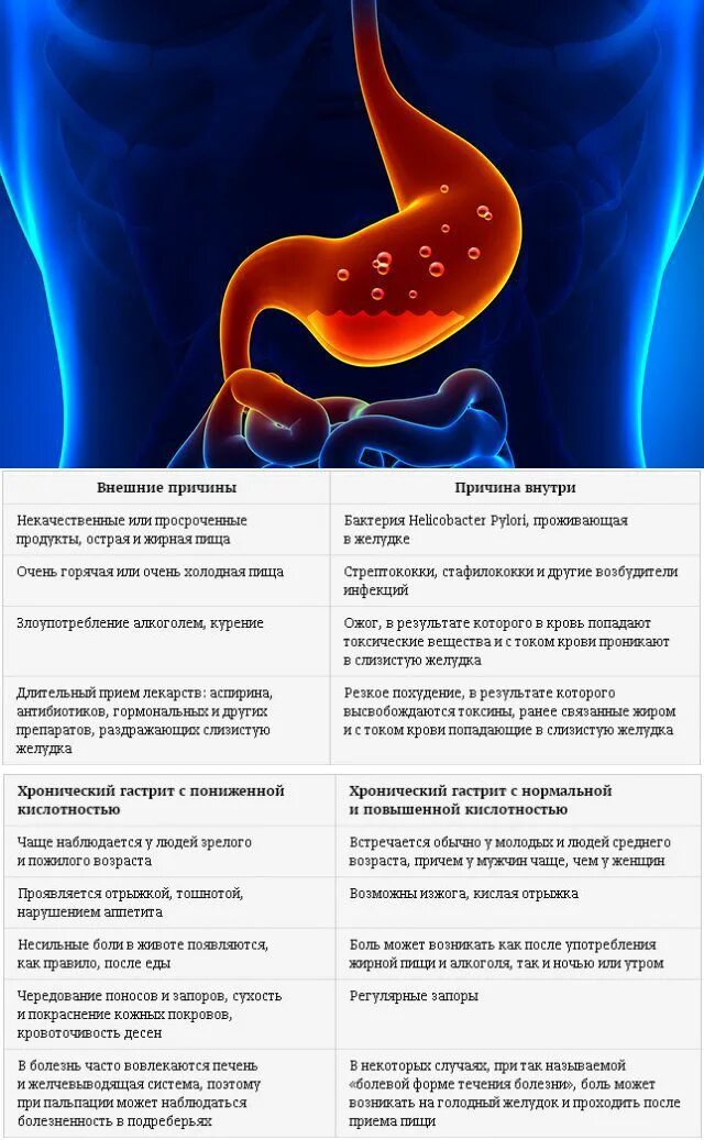 Понижающий кислотность желудка. Симптомы снижения кислотности желудочного сока. гастрит повышенная кислотность. острый гастрит и хронический гастрит таблица. повышающие и понижающие кислотность желудка.