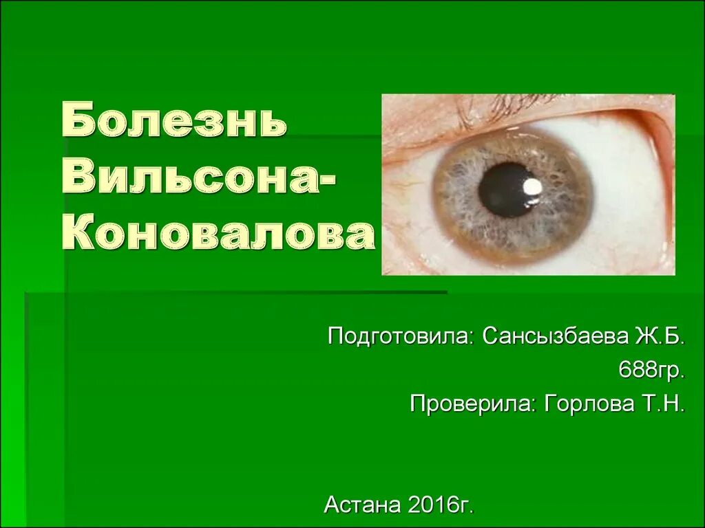 Синдром вильсона коновалова что это такое простыми. Гепатоцеребральная дистрофия (болезнь Вильсона). Гепатоцеребральная дистрофия Вильсона Коновалова. Кольца Кайзера Флейшера при Вильсона Коновалова. Болезнь Уилсона-Коновалова.