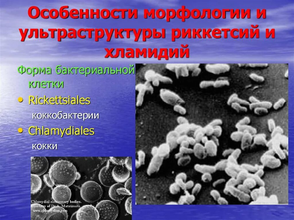 Хламидии формы. Хламидии морфологиярикетсии морфологии. Ультраструктура риккетсий. Строение риккетсий и хламидий. Морфология и строение риккетсий.