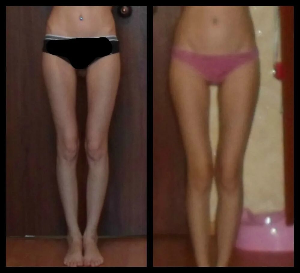 Один вес разное тело. Стройные ноги до и после. Фигуры девочки подростка с животиком. Тонкие икры ног. Живот девушки.