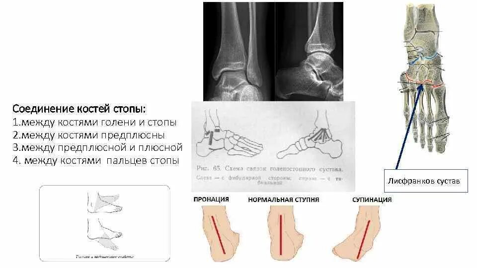 Соединение берцовых костей. Соединение берцовых костей