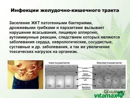 Желудочно кишечная аллергия