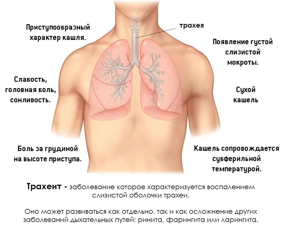 Бронхит слабость температура. Трахеит бронхит пневмония. Воспаление бронхов и легких. Болят легкие при бронхите.