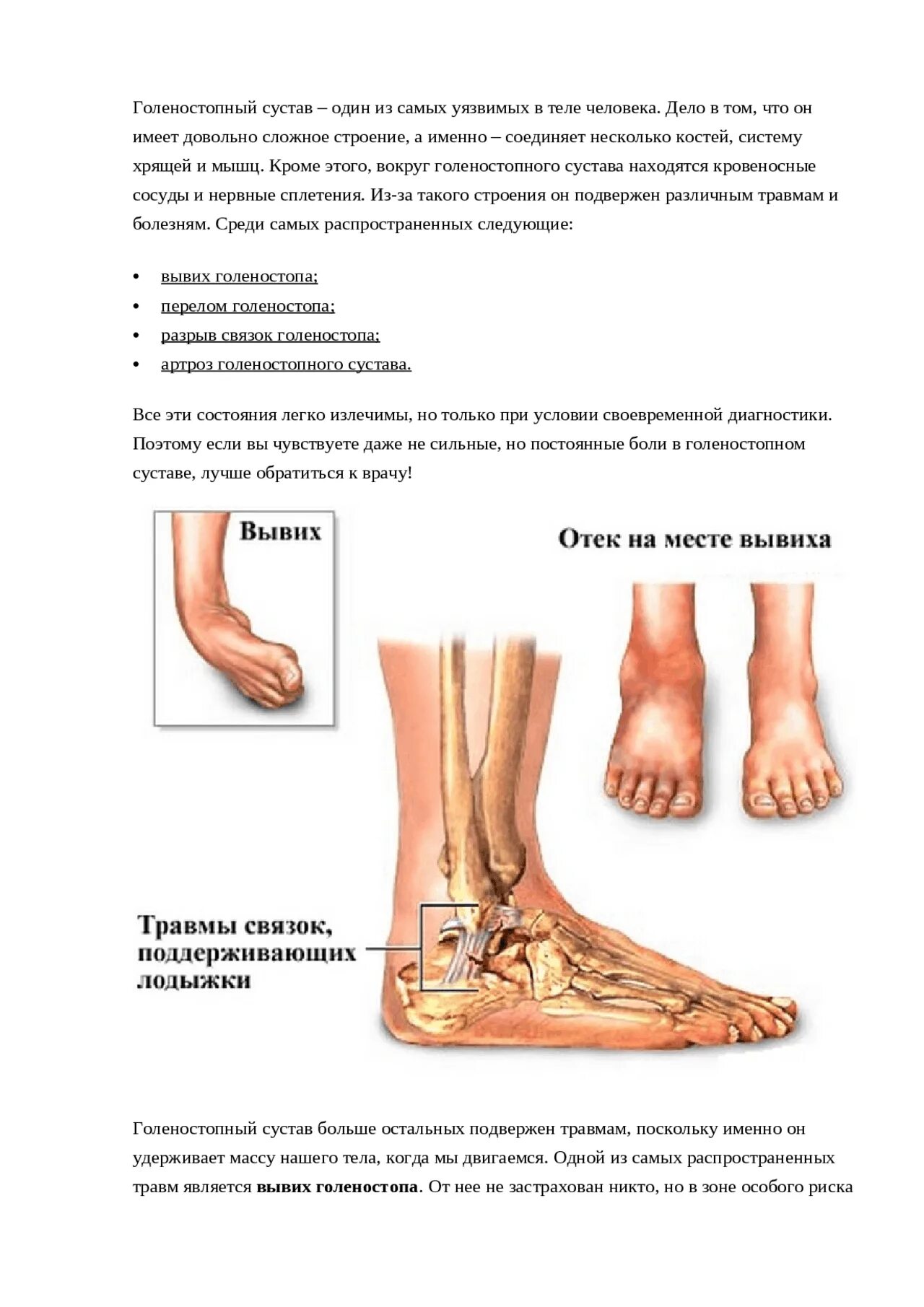 Диагноз голеностопный сустав. Функции голеностопного сустава. Голеностопный сустав вспомогательные элементы. Строение связок голеностопа. Голеностоп схема.