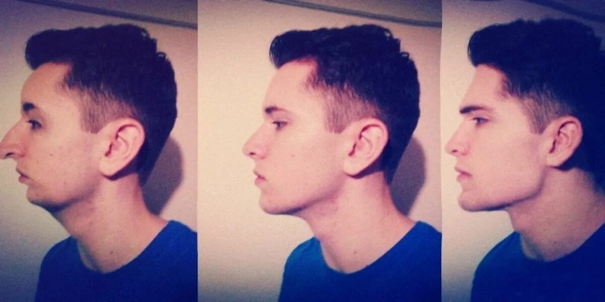 Incel jawline. Chad Slayer incel. Инцел Нормис Чад. Инцел внешность.