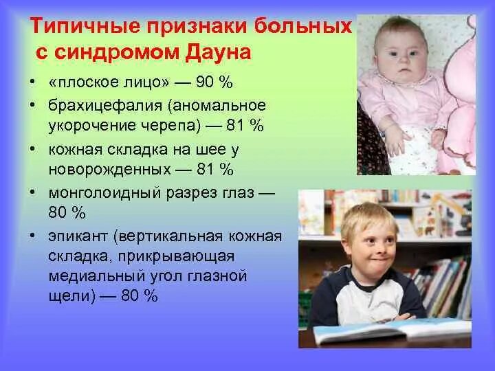 Синдром Дауна у новорожденных. Признаки симптома дауна