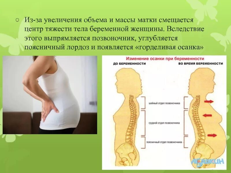 Осанка беременных. Позвоночник у беременных. Изменение позвоночника при беременности. Изменение осанки при беременности.