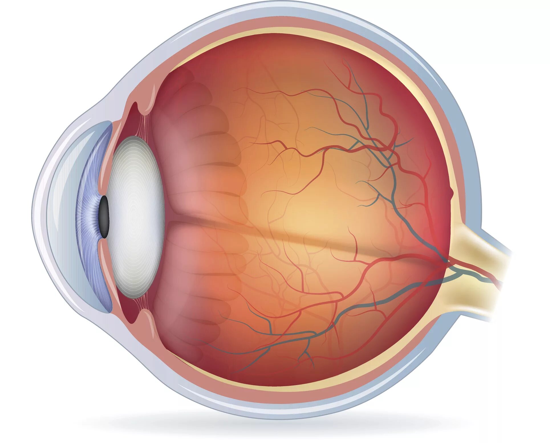 Нейробластома сетчатки. Роговица глаза с миопией. Роговица это оболочка глаза. Склера миопия. Глаукома латынь