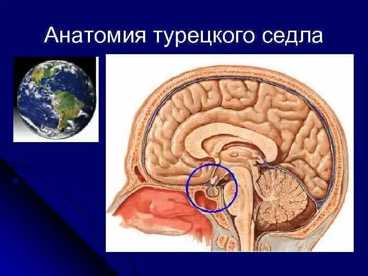 Гипофиз седло. Гипофиз в турецком седле. Анатомия турецкого седла в головном мозге. Гипофиз и турецкое седло на мрт. Диафрагма турецкого седла гипофиза.