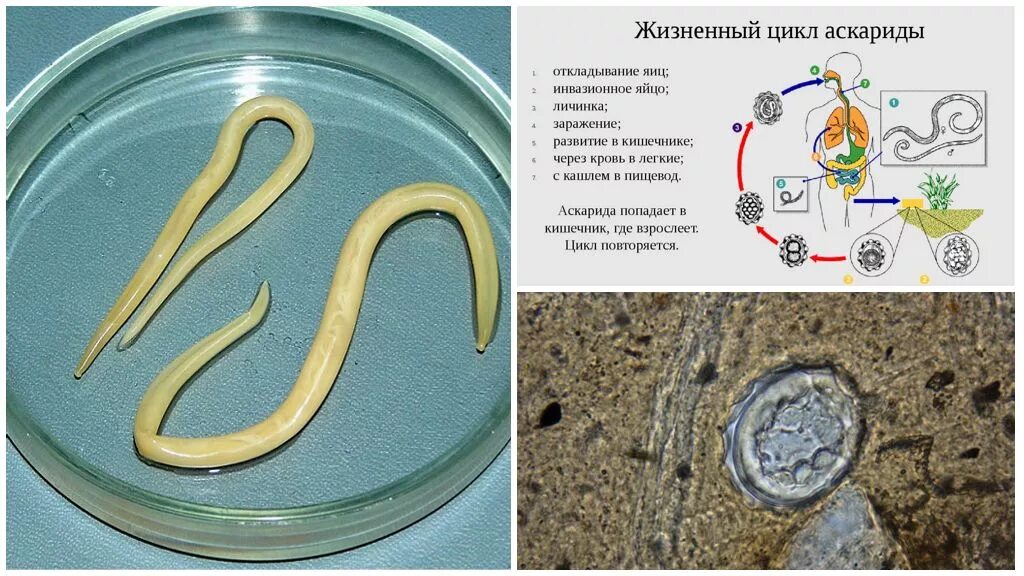 Паразиты черви аскариды. Нематоды Эустронгилидесы (eusrongylides). Строение нематоды круглых червей. Круглые черви аскарида человеческая.