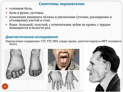 Какие изменения кожи характерные для орловской - фото презентация 