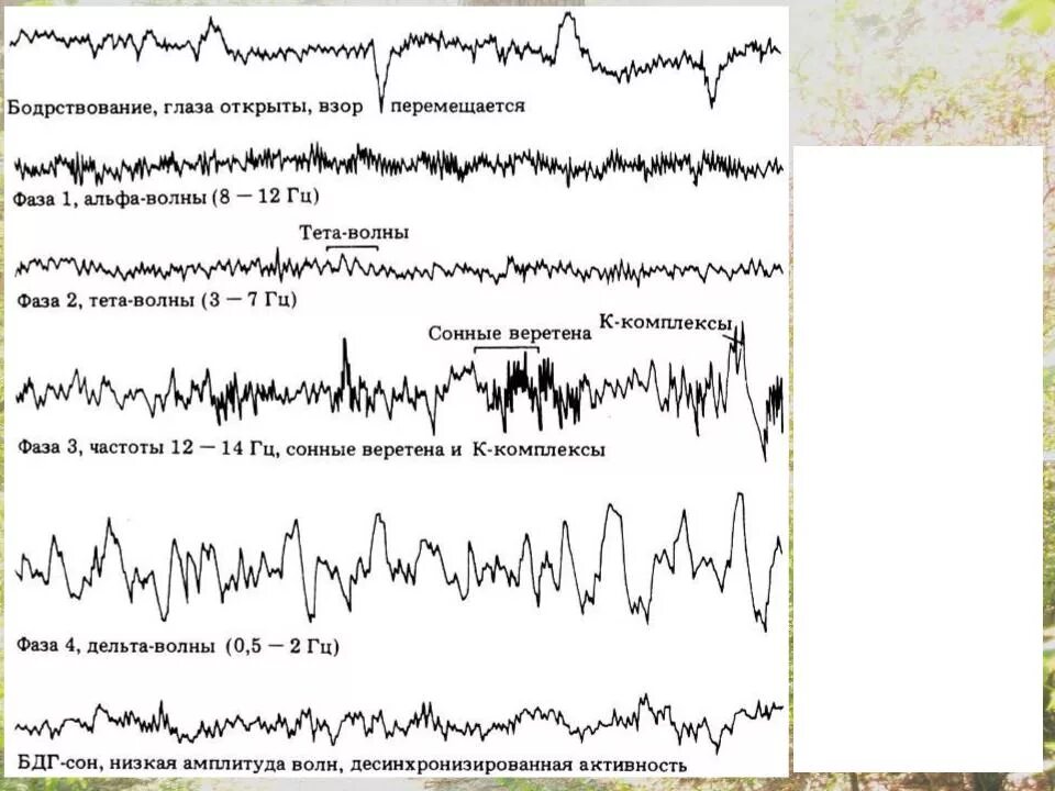 Ээг бодрствования. Сонные веретена и к-комплексы на ЭЭГ. Сонные веретена и к-комплексы на ЭЭГ характеризуют. Энцефалограмма бодрствования ритм. Активное бодрствование ЭЭГ.