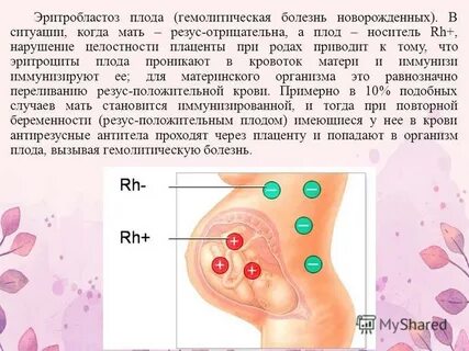 Резус болезнь